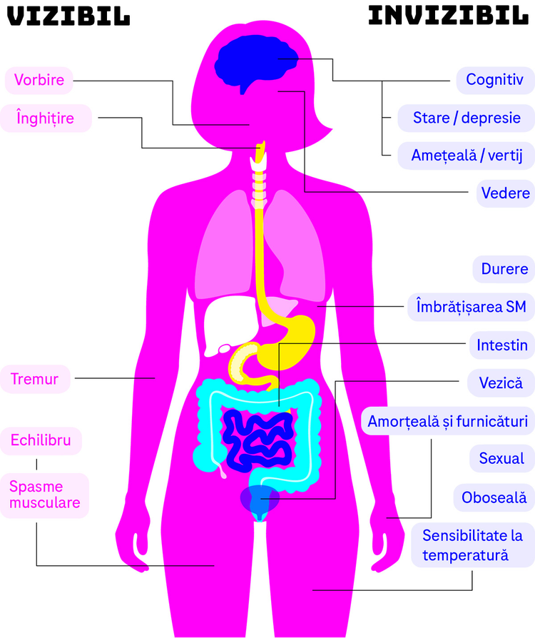 Anatomical diagram of woman with labels for visible and invisible symptoms, indicating the relevant body parts